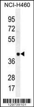 LRRC38 Antibody