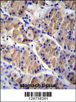 LRRC38 Antibody