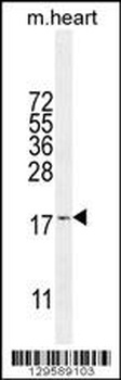 SNRNP27 Antibody