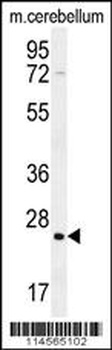 HRAS Antibody
