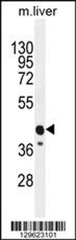 CACNG8 Antibody