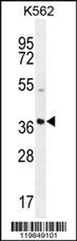 SFRP4 Antibody