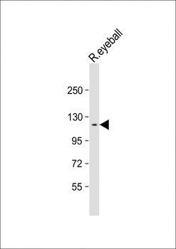 GUCY2D Antibody