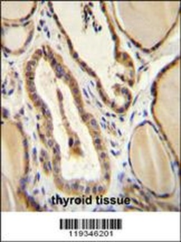 GUCY2D Antibody