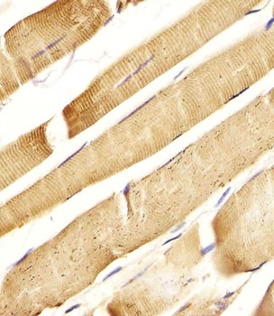 CD130 Antibody