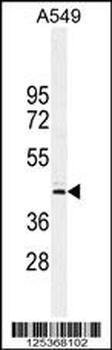 NOL4L Antibody