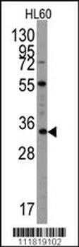 UBTD1 Antibody