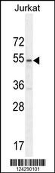 MPP1 Antibody