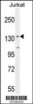 PPP1R3A Antibody