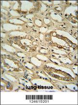 GGTLC2 Antibody