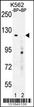 DEPDC5 Antibody