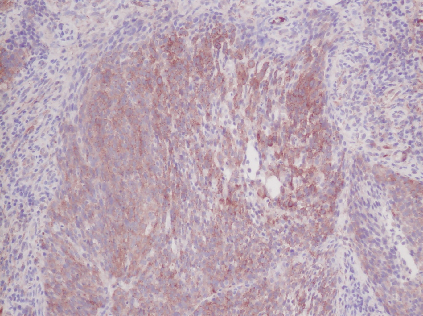 IL-6 Antibody [1.2-2B11-2G10]