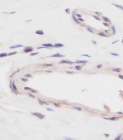 VEGFA Antibody