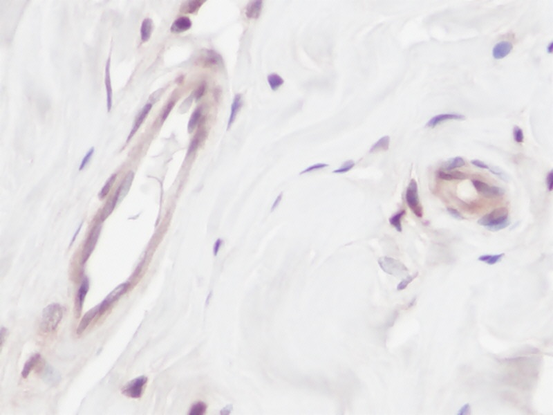 VEGFA Antibody