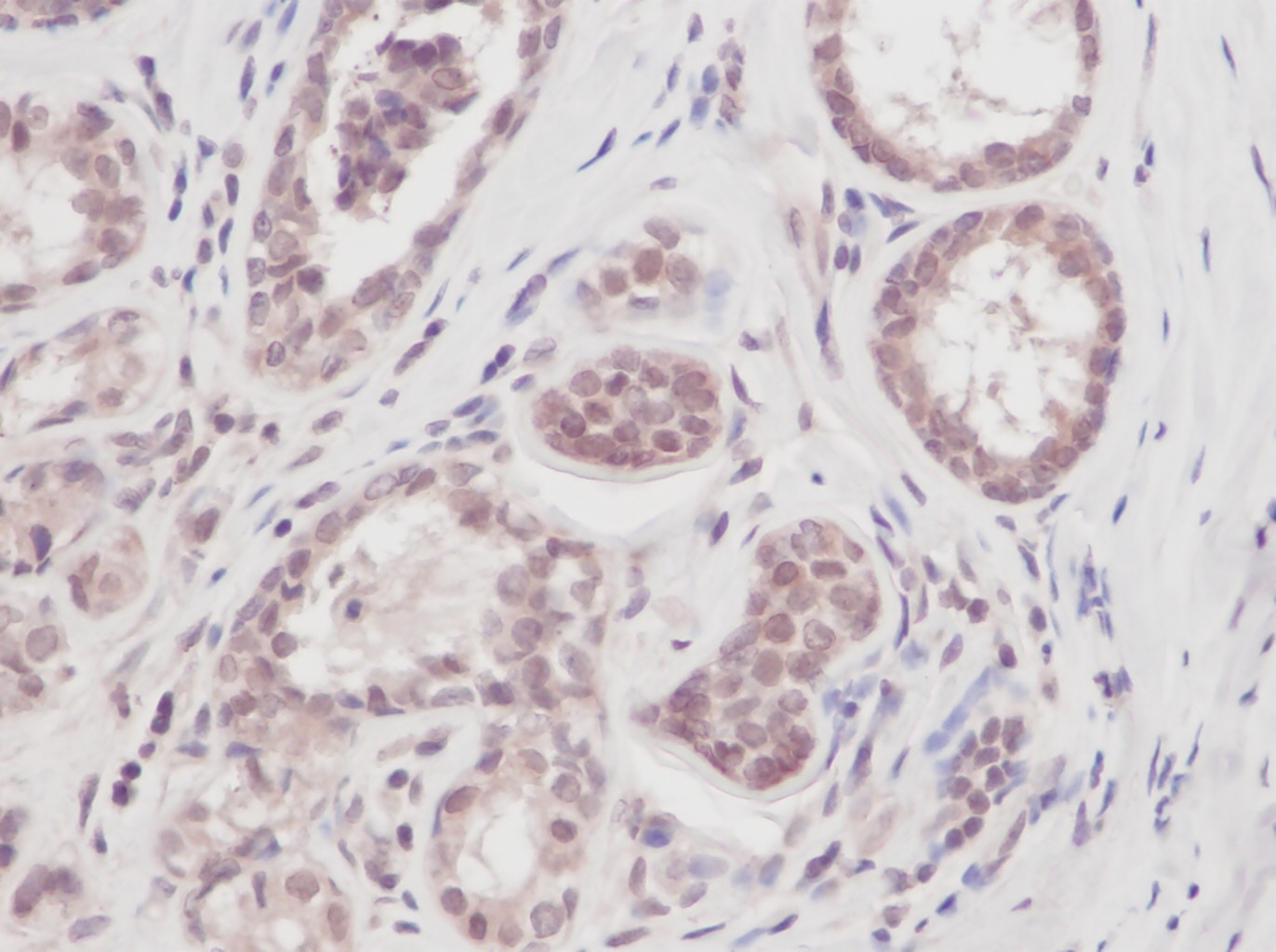 VEGFA Antibody