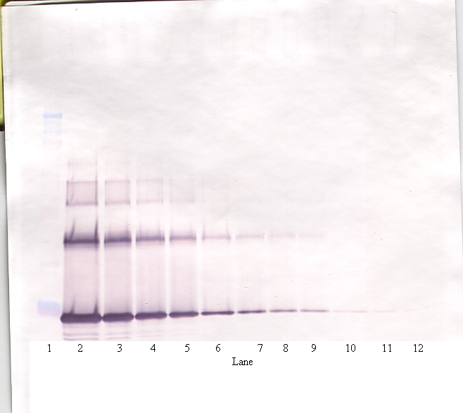 IL-6 Antibody