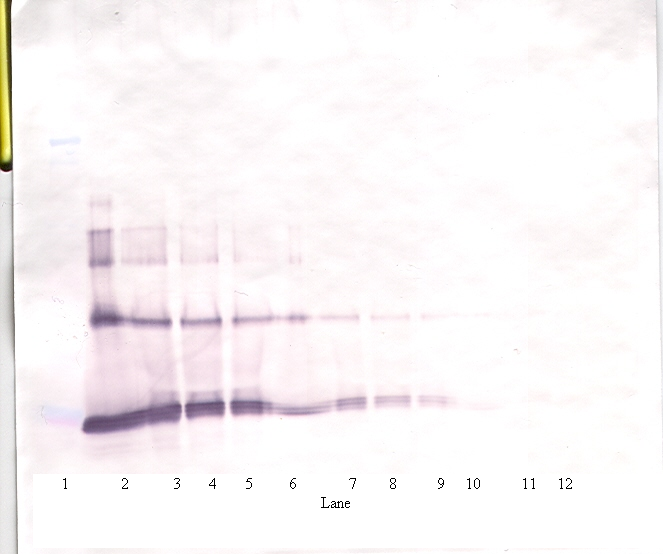 IL-6 Antibody