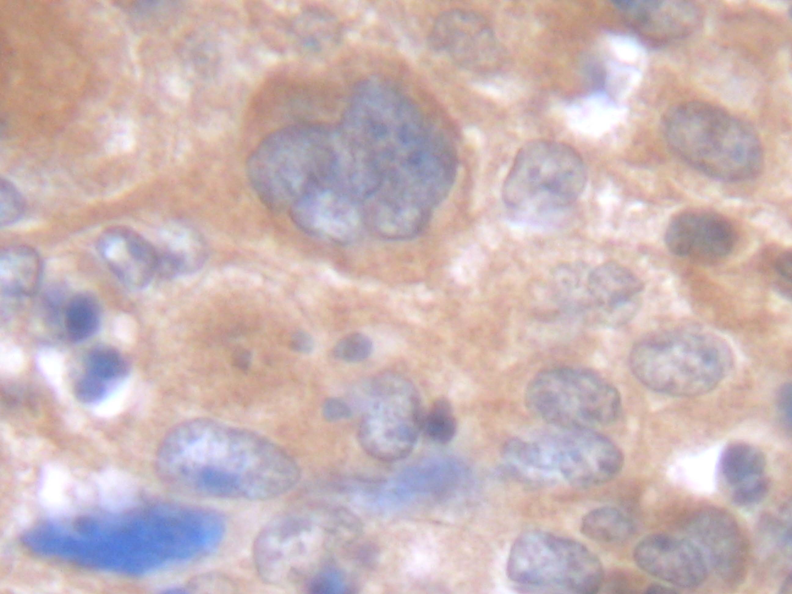 IL-6 Antibody