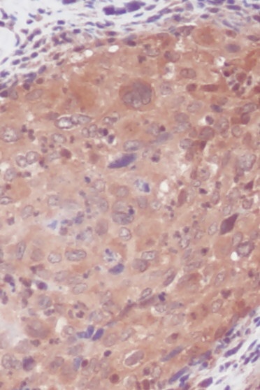 IL-6 Antibody