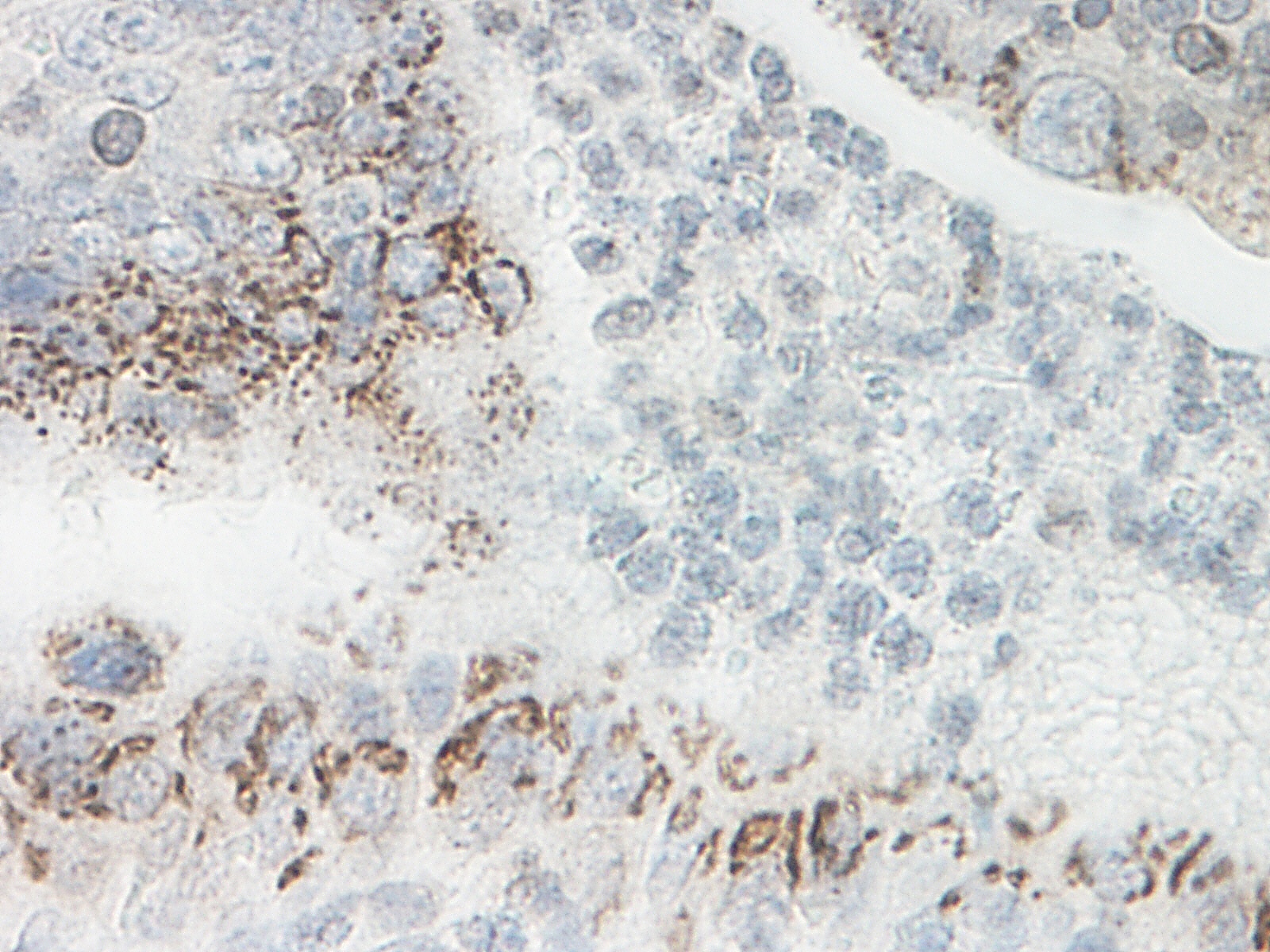 CXCL1 Antibody