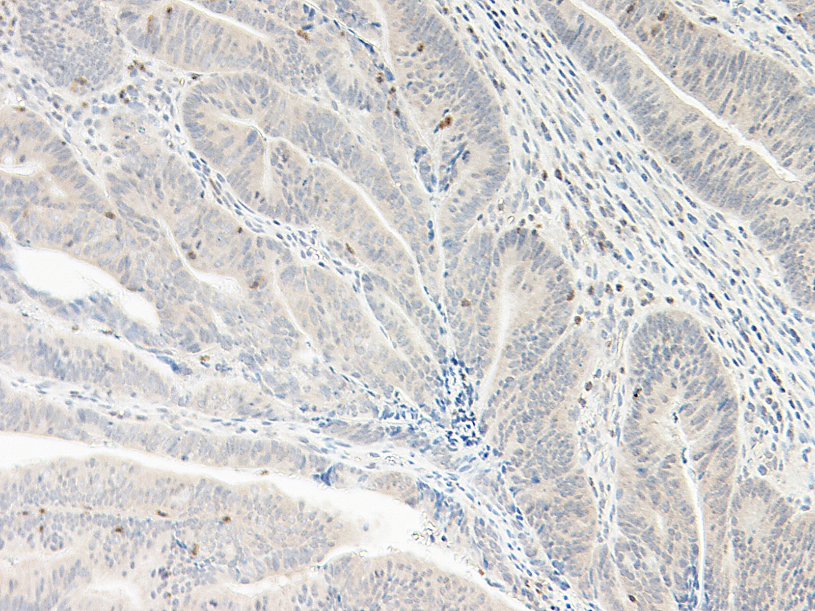 CXCL5 Antibody