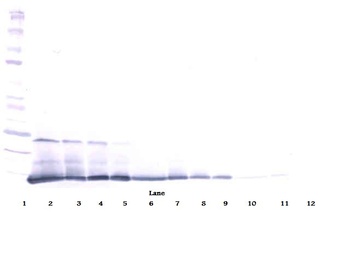 IL-5 Antibody