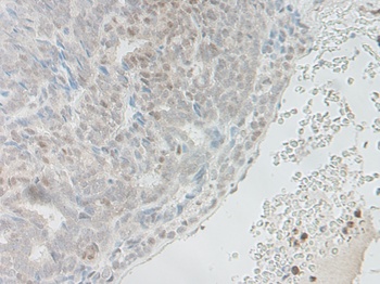 NAMPT Antibody