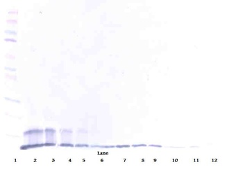 TNFRSF10B Antibody (Biotin)