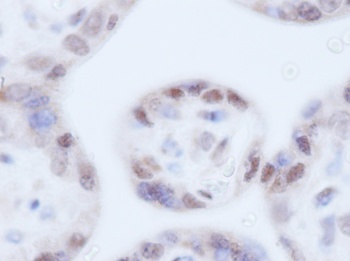 IGFBP3 Antibody