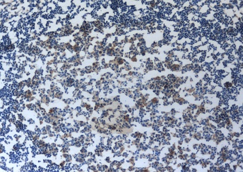 sIL-2Ra Antibody [SB-647]