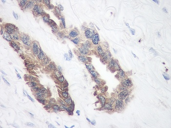 TIMP-1 Antibody
