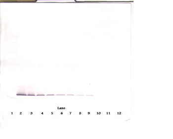 COL18A1 Antibody (Biotin)