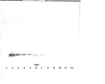 COL18A1 Antibody (Biotin)