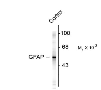 Glial Fibrillary Acidic Proetin (GFAP) Antibody