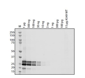 SARS Coronavirus (HSZ-Cc) Envelope Antibody