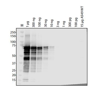 SARS Coronavirus (HSZ-Cc) Nucleocapsid Antibody