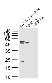 SARS Nucleocapsid Antibody [14B3D]