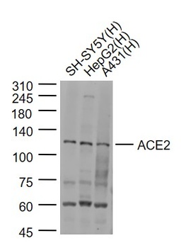 ACE2 Antibody