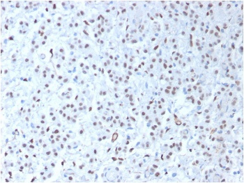 Recombinant Wilms Tumor 1 Antibody [WT1/1434R]