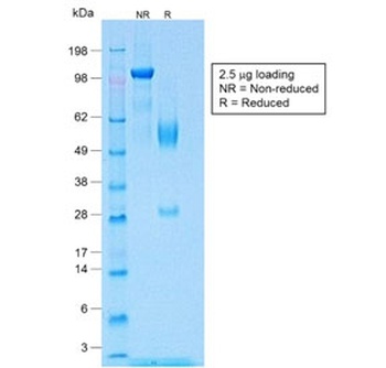 Recombinant Wilms Tumor 1 Antibody [WT1/1434R]