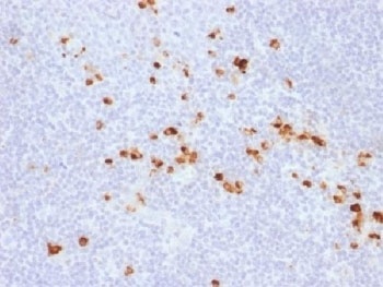Recombinant IgG Heavy Chain Antibody [IG507R]
