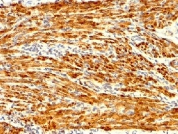 Recombinant Calponin Antibody [CNN1/1408R]