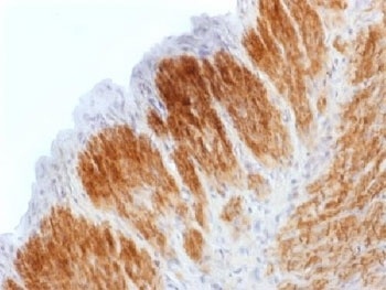 Recombinant Calponin Antibody [CNN1/1408R]