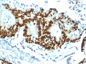 Recombinant p53 Antibody [TP53/1799R]