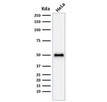 Recombinant p53 Antibody [TP53/1799R]