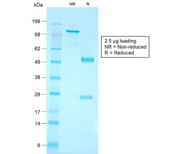 Recombinant CD79a Antibody [IGA/1790R]