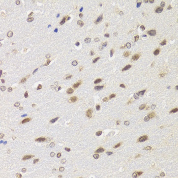 BAZ1B Antibody, KO Validated