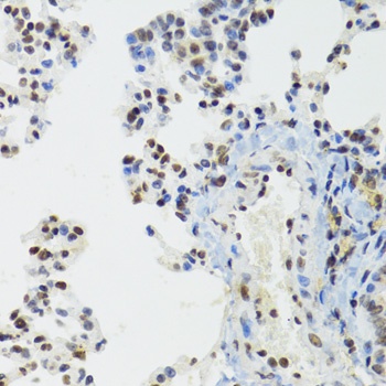 BAZ1B Antibody, KO Validated