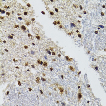 BAZ1B Antibody, KO Validated