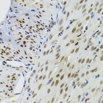 BAZ1B Antibody, KO Validated